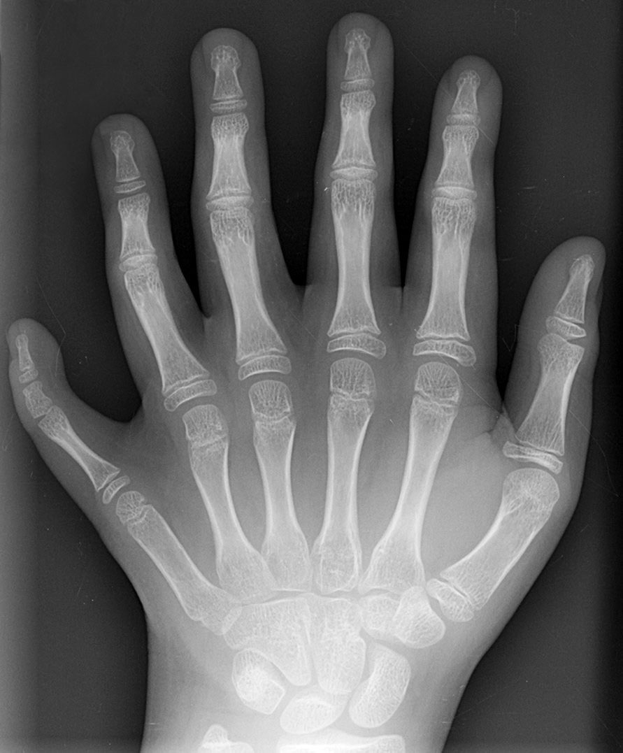 My Hand