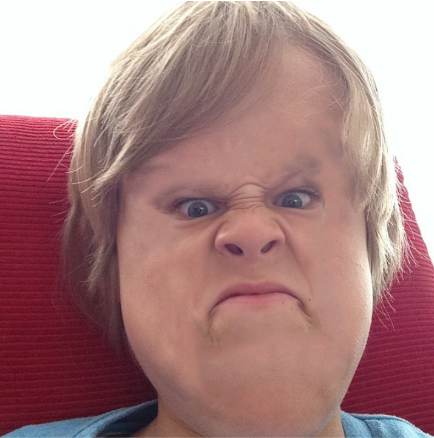 cas