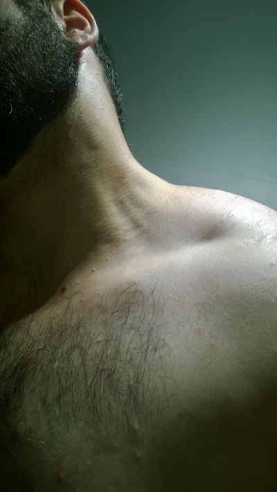No Clavicle