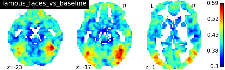 henson2010faces_std_avg_z_famous_faces_vs_baseline.png