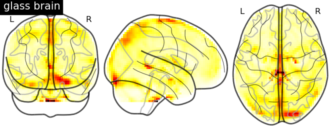 glassbrainvariancefamous_faces_vs_baseline.png