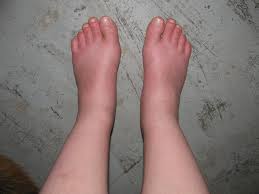 Toes