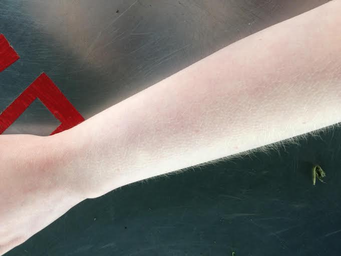 arm.jpg