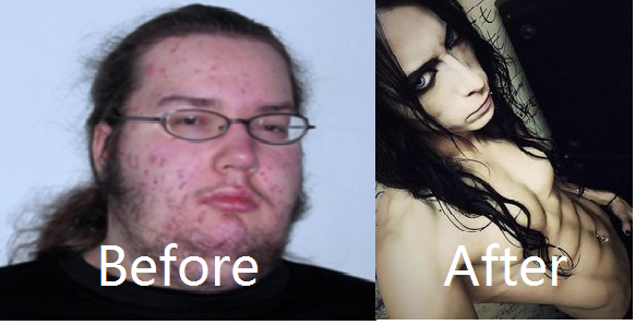 lol