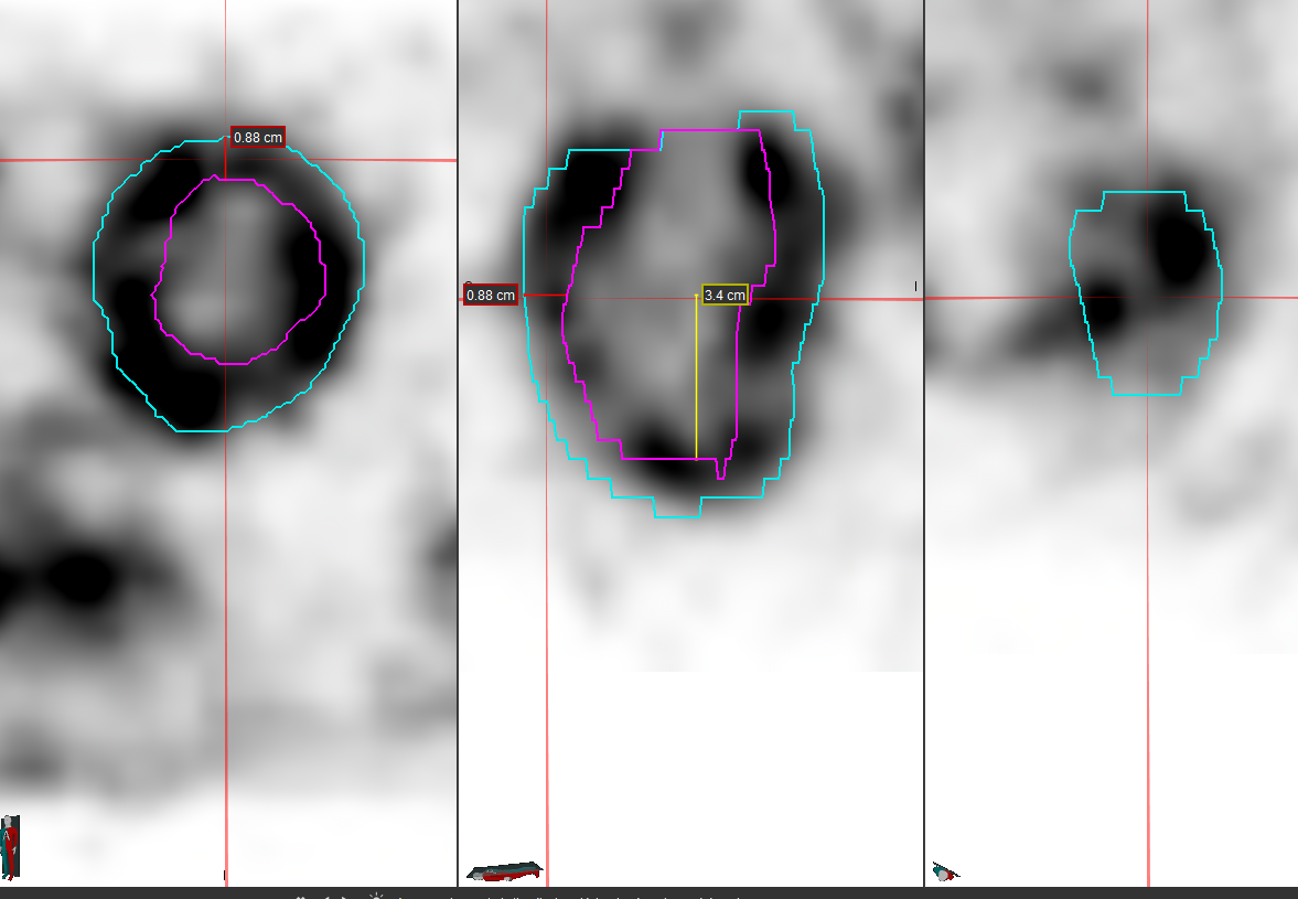 WallThickness.PNG