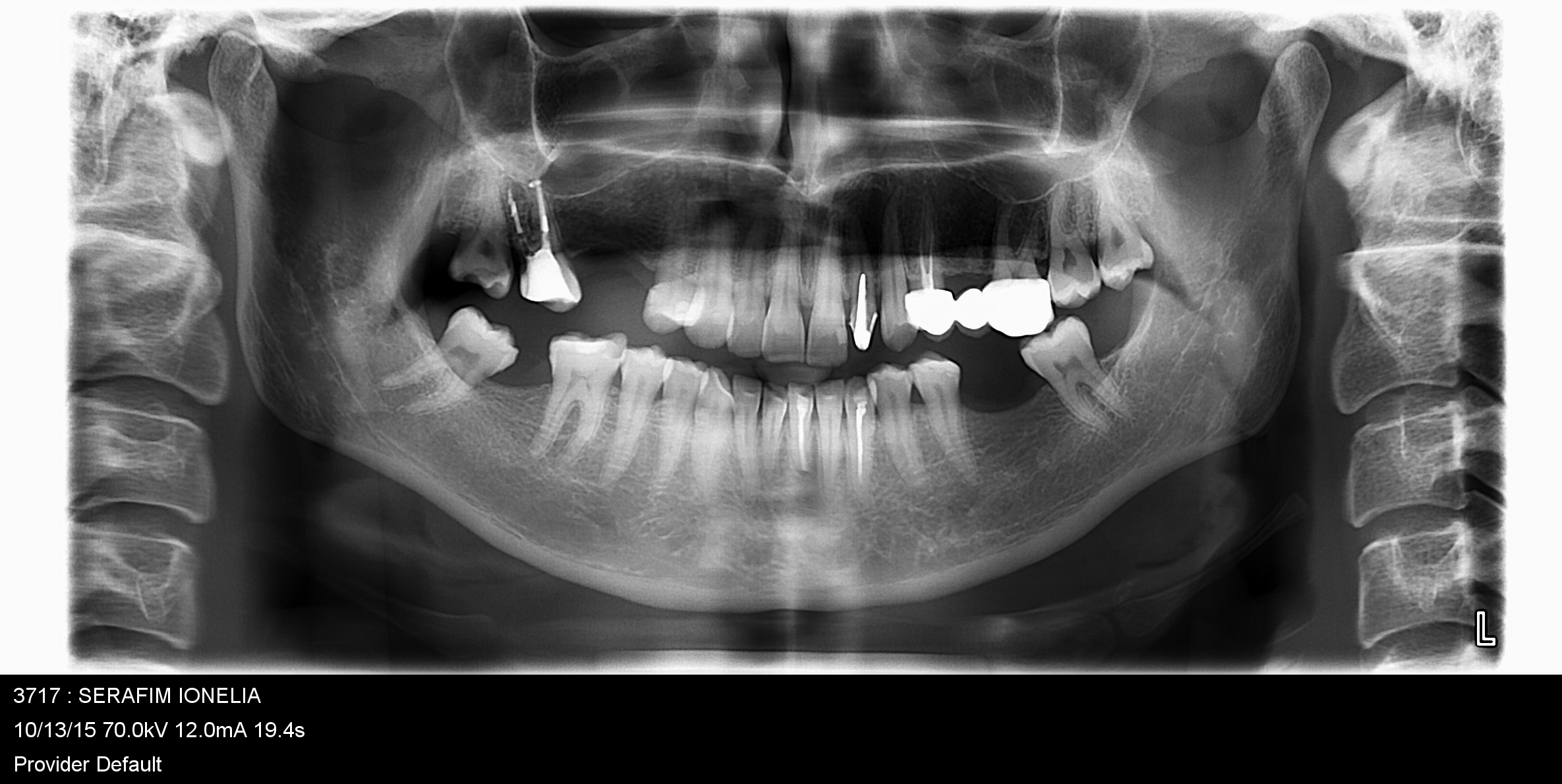 radiografie