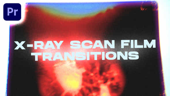 47814794-x-ray.jpg