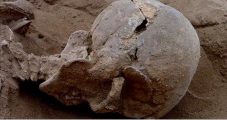 skull