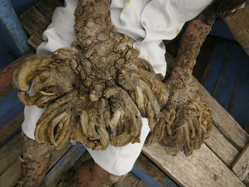 treemanjonfrank.jpg