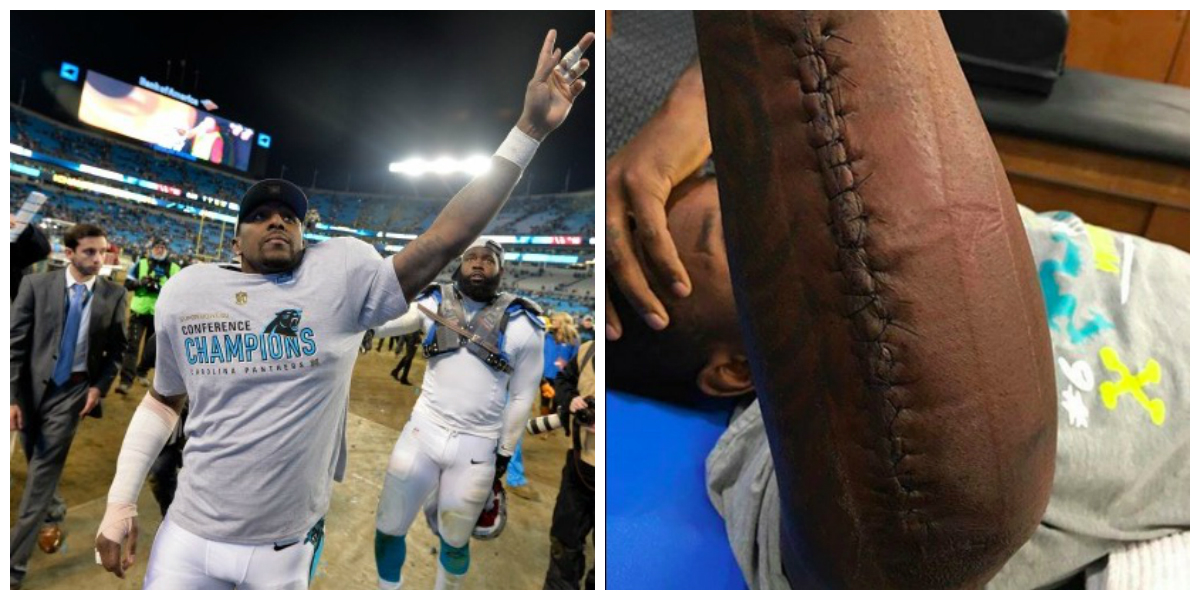 armcollage.jpg