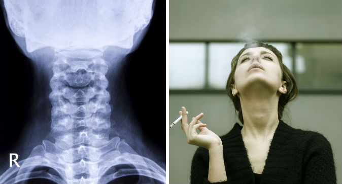 neck.jpg