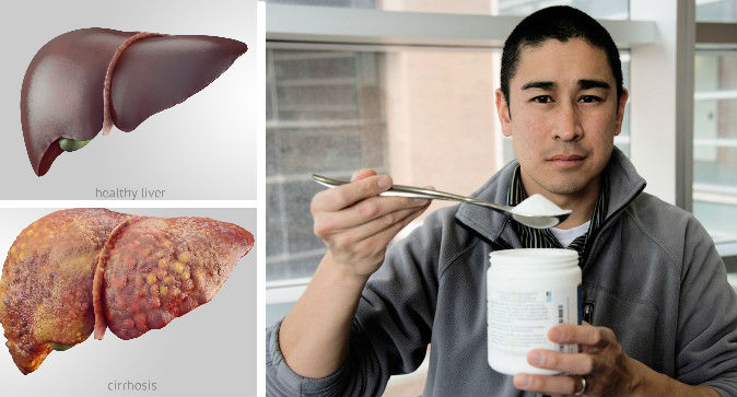 Fattyliver.jpg