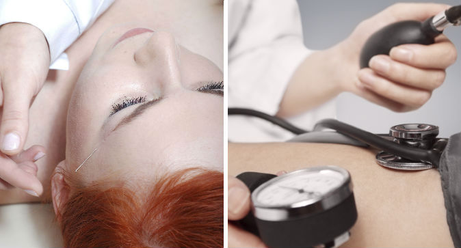 acupuncture2.jpg