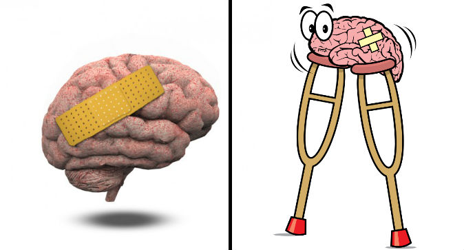BRAIN2.jpg