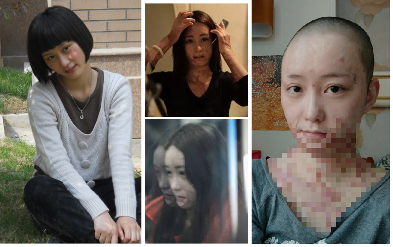 girl_disfigured1.png