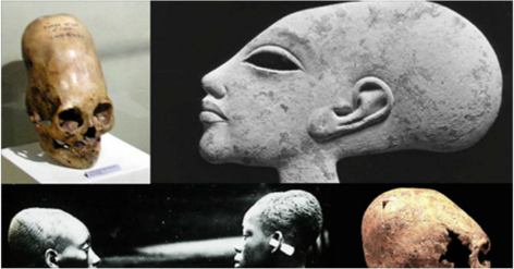 ElongatedSkulls.PNG