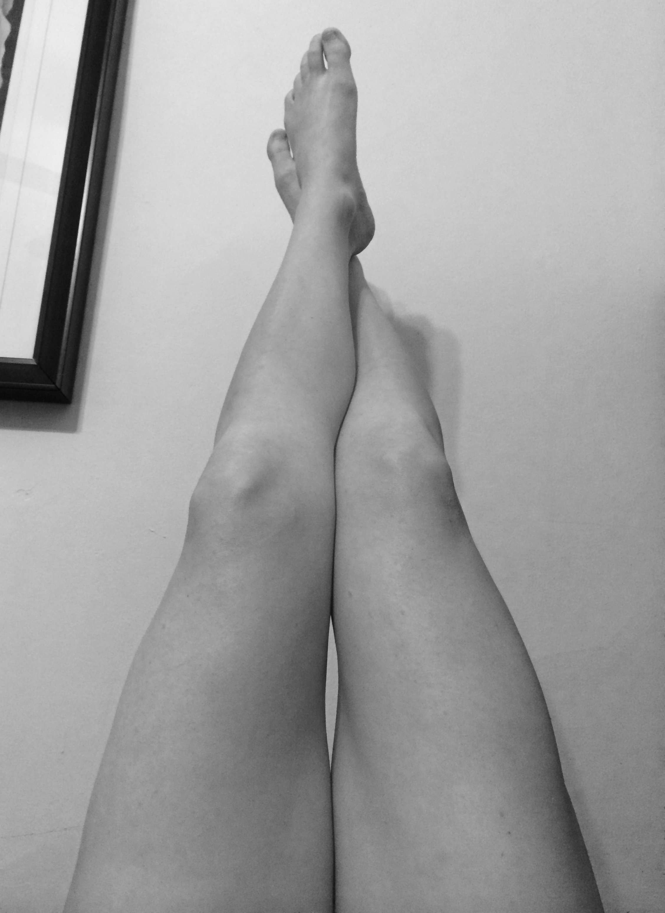 Legs