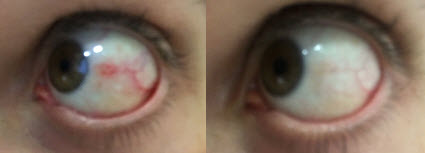 eyeboth.jpg
