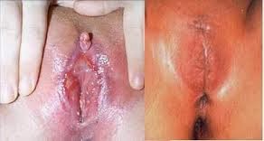 a1c16-fgminamerica-beforeafterfgm.jpg
