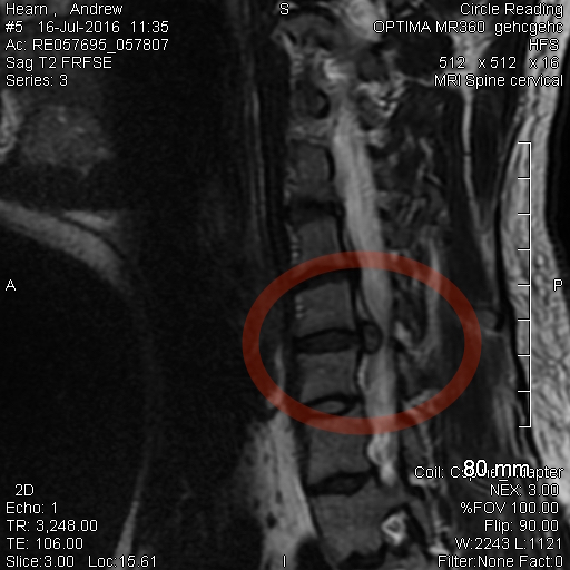 mri.jpeg