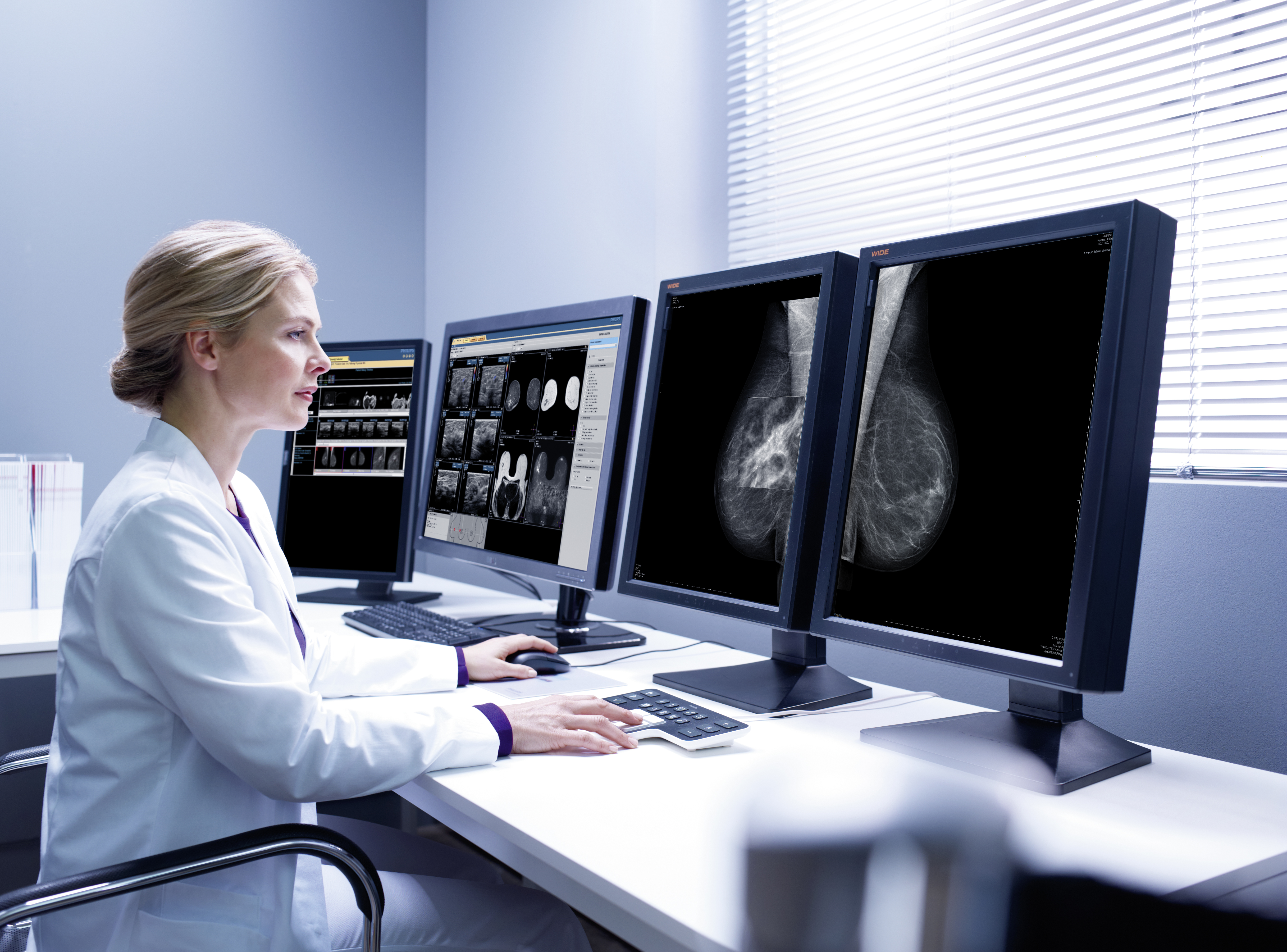 Mammographyworkstation_PhilipsIntelliSpaceBreast.jpg