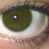 Eye with flash
