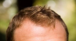 hair2