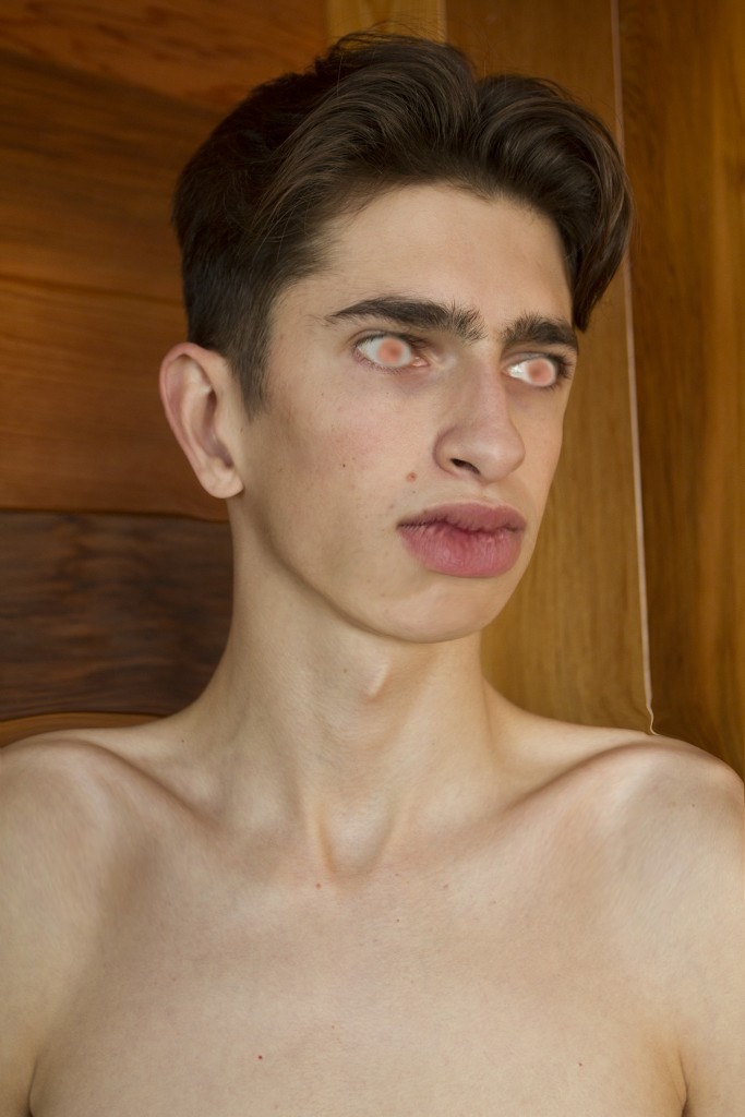 lolmatt