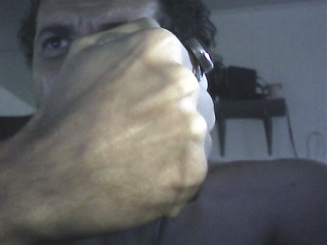 Scar in my right hand