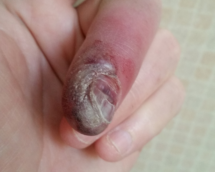 The Finger - Day One
