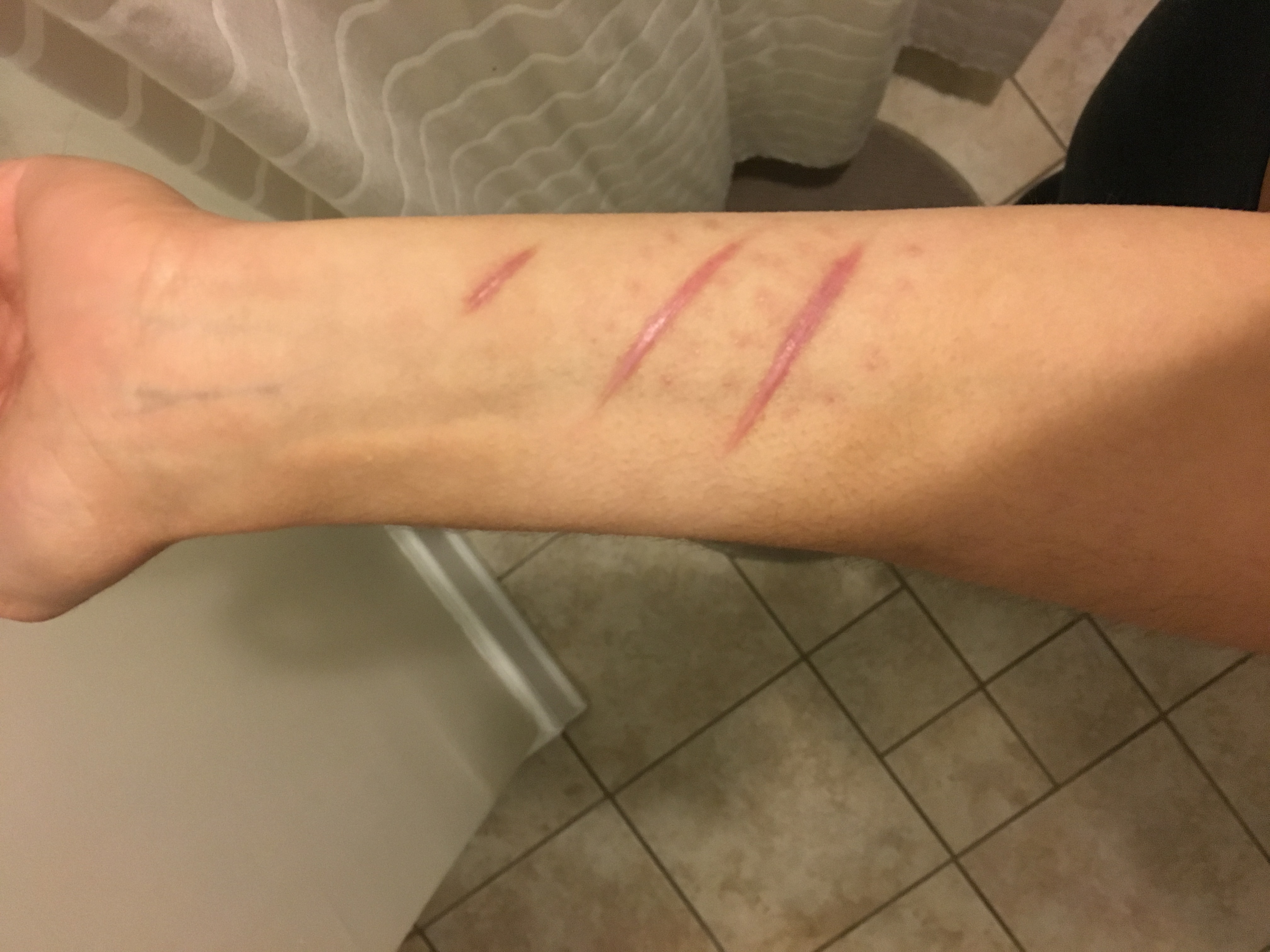 Arm