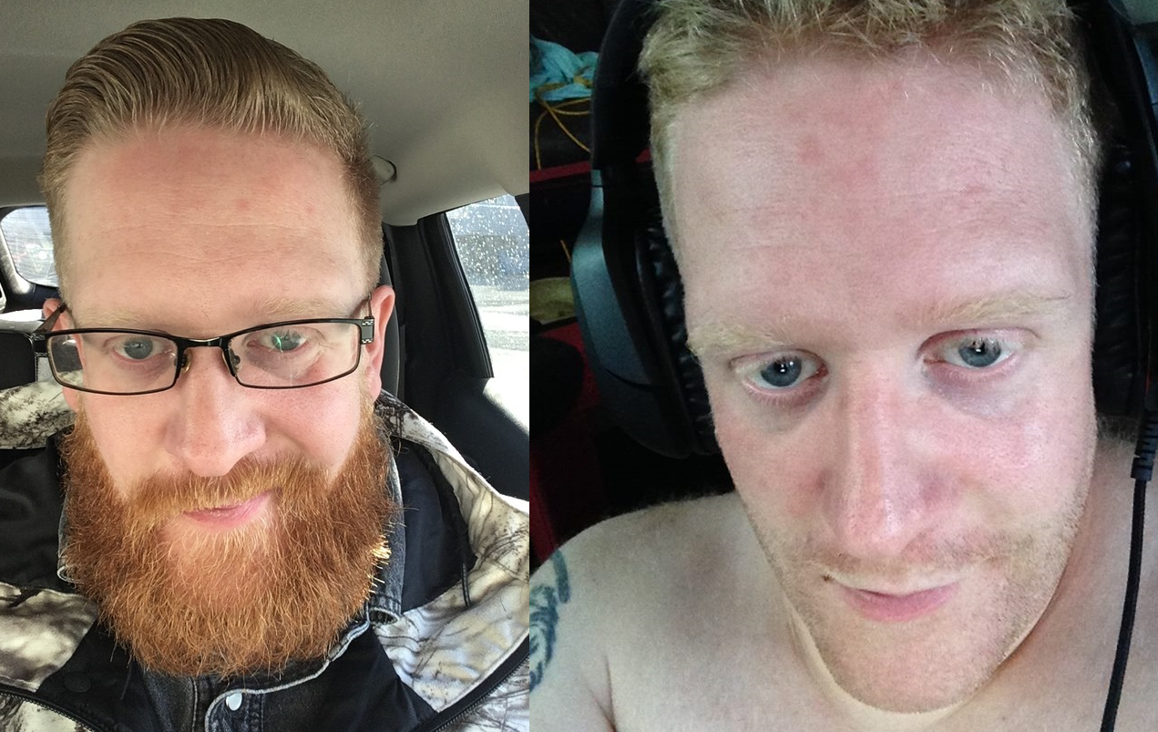 lolbeard.png