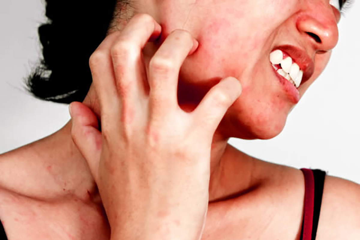 nz-itch_face_woman_2.jpg