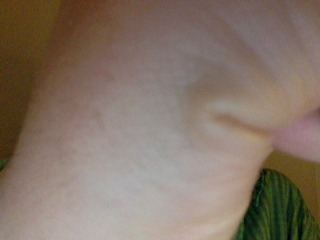 blob