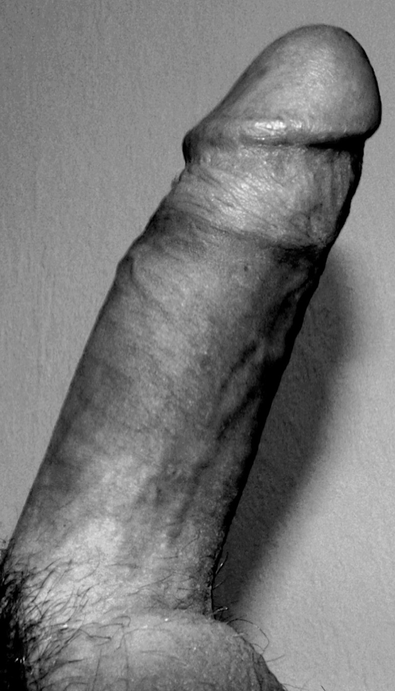 Eregierter Penis