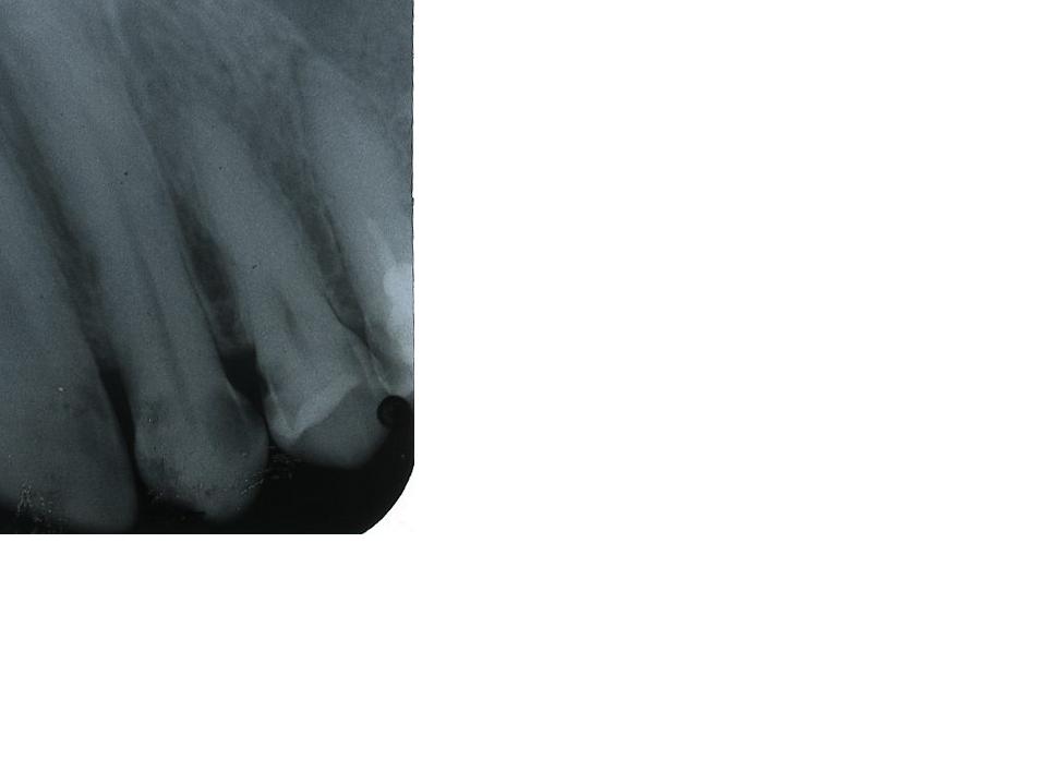 tooth.JPG