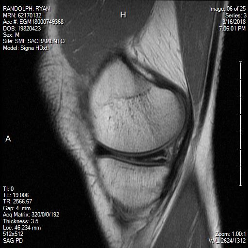 mri.jpg