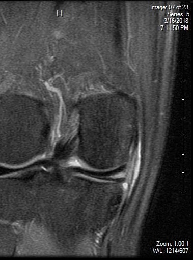 mri2.jpg