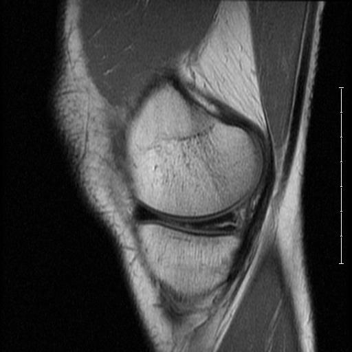 mri3.jpg