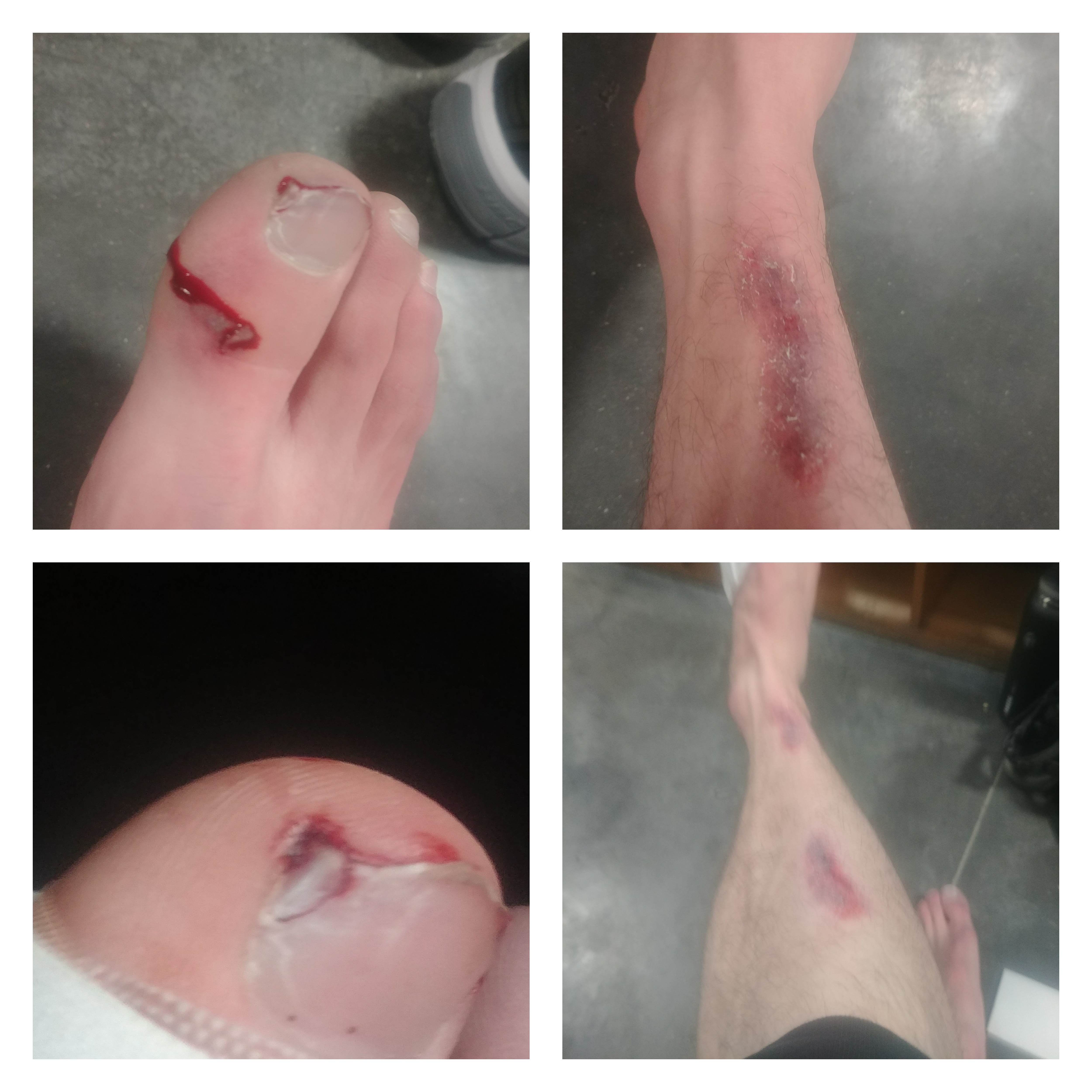 Discolouration on shin