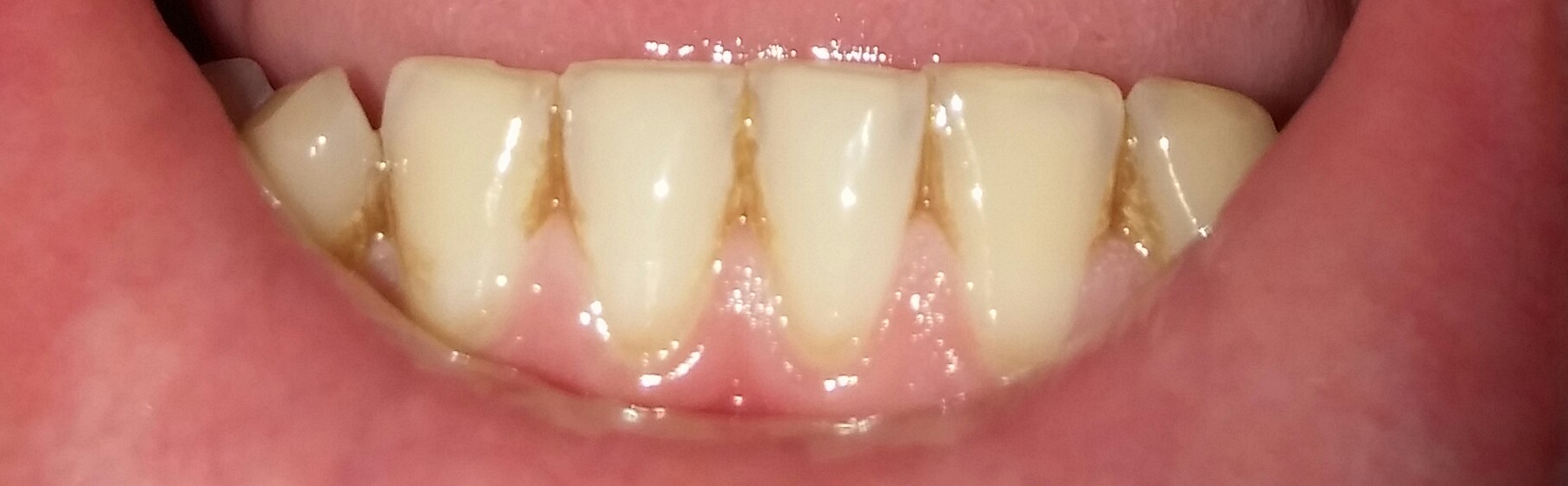 20180711_011927.jpg