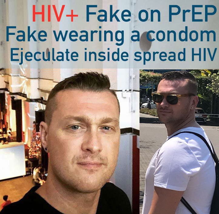Maciej Setniewski lies about hiv+艾滋病