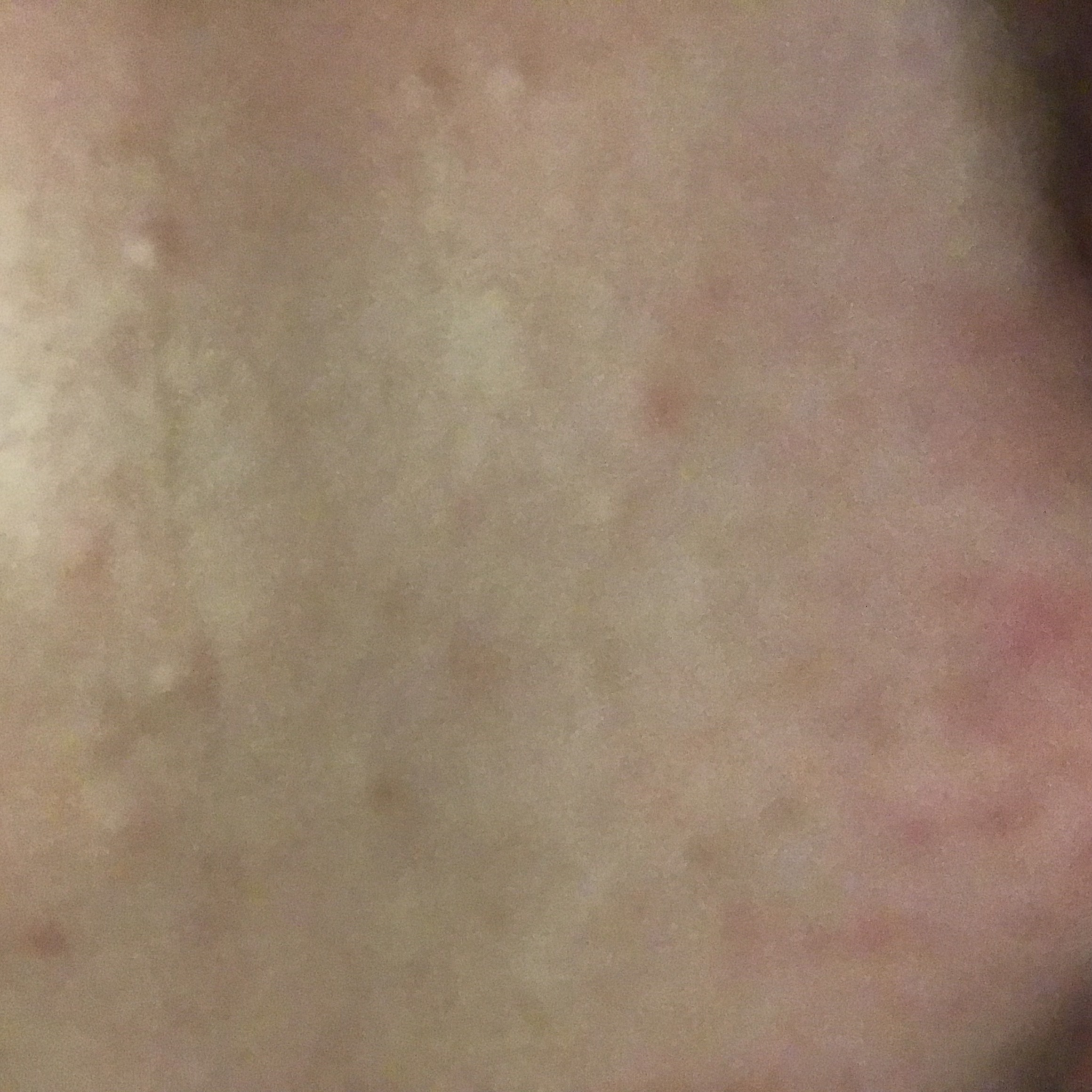 forehead