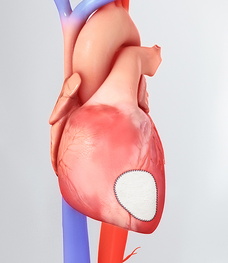 patched-heart.jpg