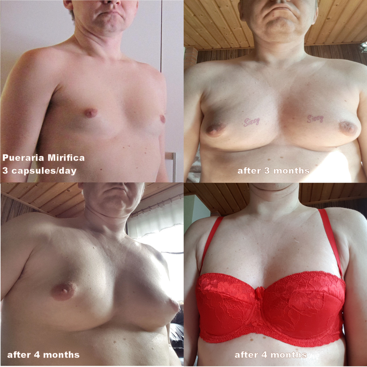 Sissyfaggot boobs - before and after