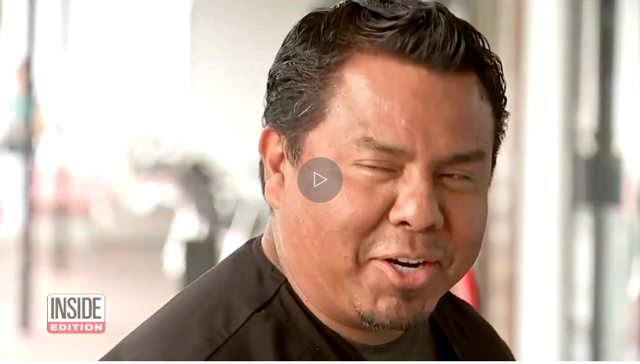 botox.jpg