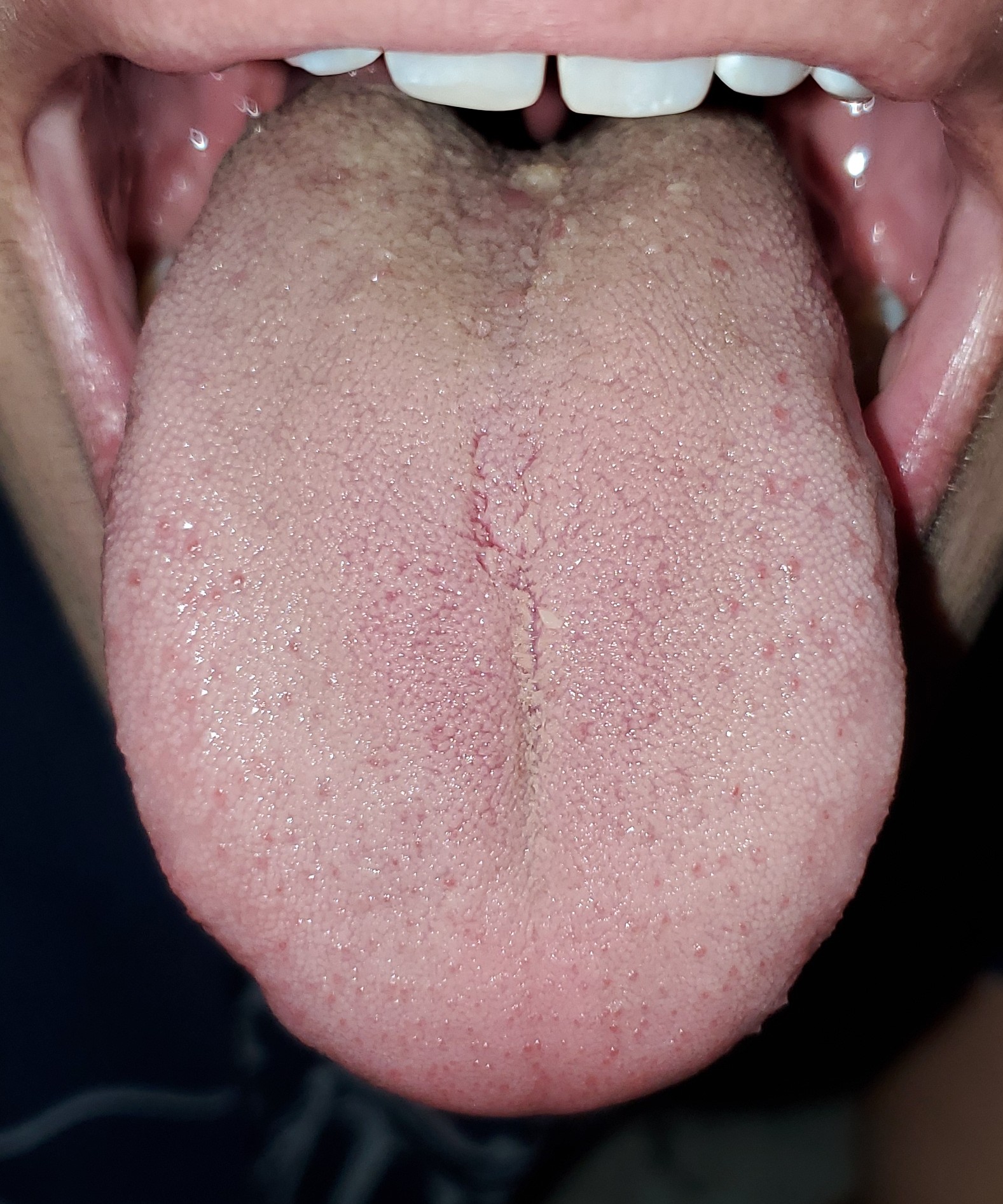 20201227_1707572.jpg