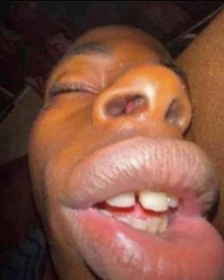 goofy