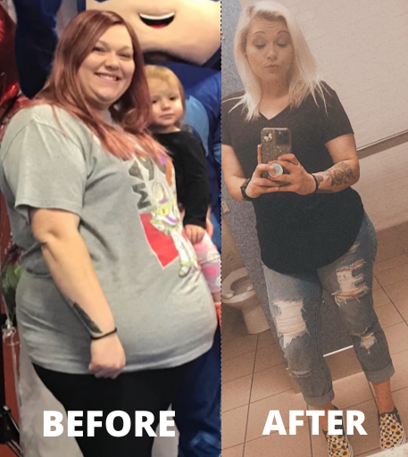 before after