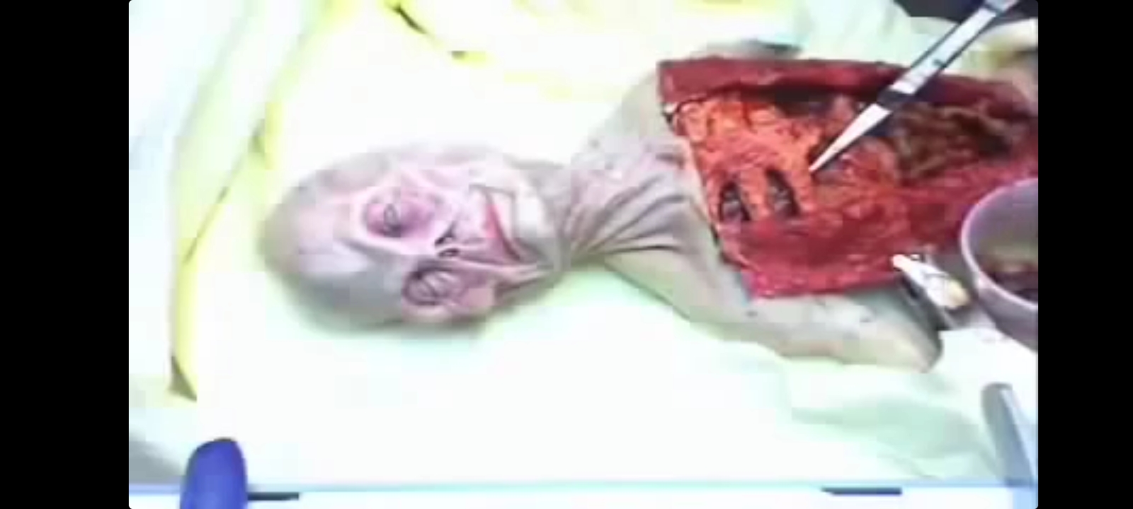 Screenshotautopsy.jpg